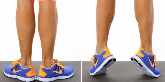 Gymnastics from varicose veins