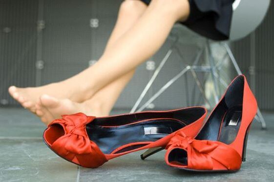 What are varicose veins